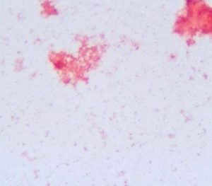 Gram-stain performed from the bacterial colonies - no organism could be seen.